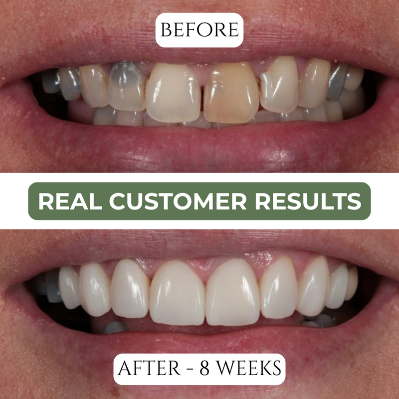 6. Yes — cavities can be reversed (and this is how)